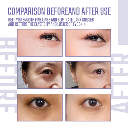 Masque Yeux Collagène et Acide Hyaluronique