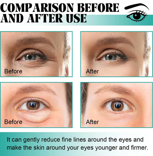 Patchs Yeux Raffermissants